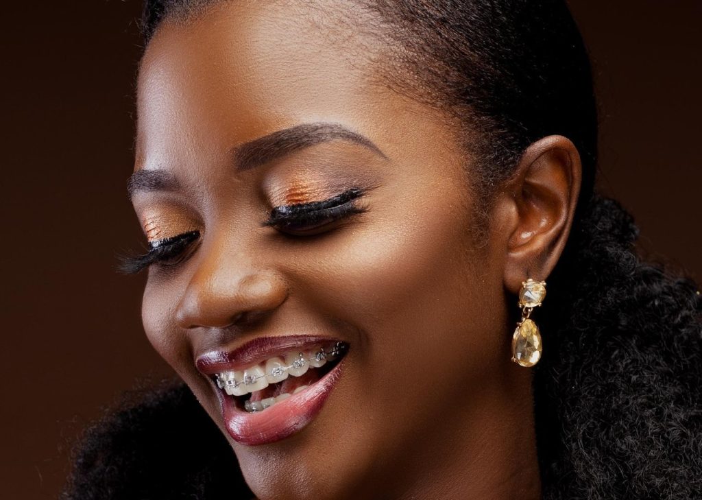 How to Keep Your Teeth White While Wearing Braces - Newslibre