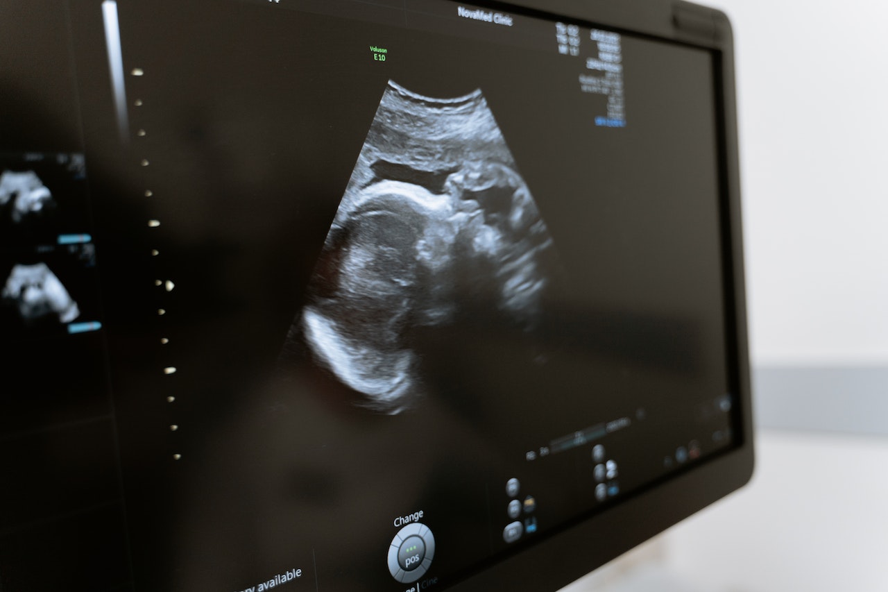 Seeing Through Sound: The Innovative Approach of Ultrasound Services 2 Seeing Through Sound: The Innovative Approach of Ultrasound Services - Newslibre