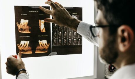 How to Prepare Yourself for Dental Implants - Newslibre