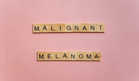 Understanding Melanoma: An Easy Guide to Navigating Skin Cancer - Newslibre