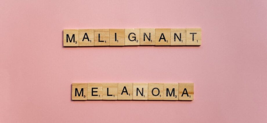 Understanding Melanoma: An Easy Guide to Navigating Skin Cancer - Newslibre