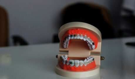 Life with Braces: 5 Smart Hacks and Tips for a Better Experience - Newslibre