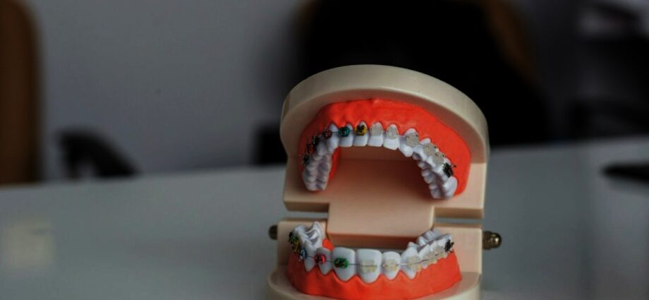 Life with Braces: 5 Smart Hacks and Tips for a Better Experience - Newslibre